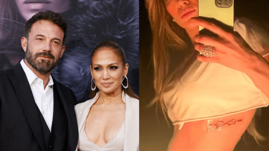 Jennifer Lopez Removes Tattoo of Ben Affleck