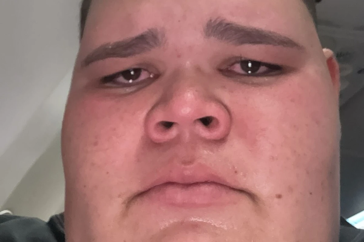 Gordão da XJ Hospitalized and Reveals Delicate Surgery