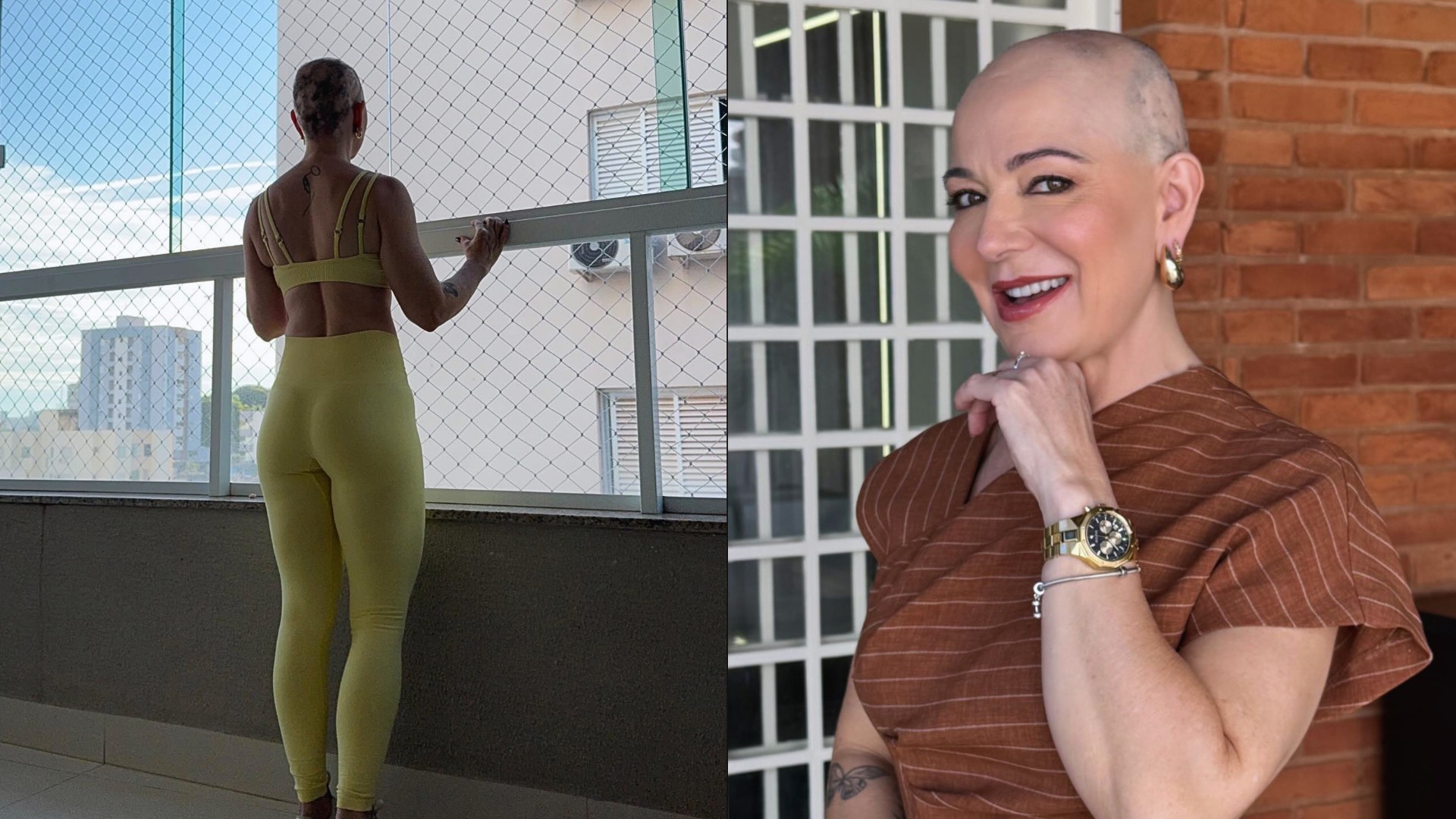 Karina Lucco jokes about new look amid alopecia treatment: 'It's hair on the nape of the neck!'